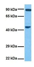 Anti-Pentraxin 3 antibody, N-term used in Western Blot (WB). GTX45054
