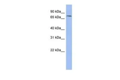 Anti-PNN antibody, N-term used in Western Blot (WB). GTX45056