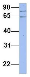 Anti-PNN antibody, N-term used in Western Blot (WB). GTX45056