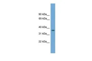Anti-NUBP1 antibody, N-term used in Western Blot (WB). GTX45063