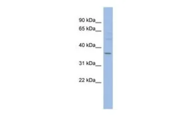 Anti-HMGCLL1 antibody, N-term used in Western Blot (WB). GTX45075