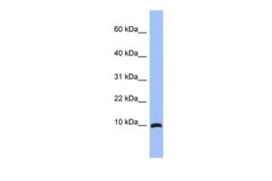 Anti-ACBD7 antibody, N-term used in Western Blot (WB). GTX45078