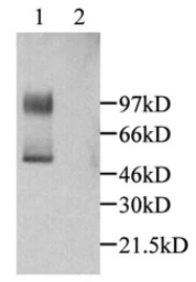 Anti-CX3CL1 antibody used in Western Blot (WB). GTX45088