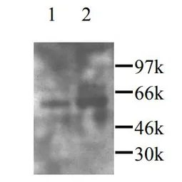 Anti-CX3CL1 antibody used in Western Blot (WB). GTX45091