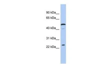 Anti-C1orf190 antibody, Internal used in Western Blot (WB). GTX45093