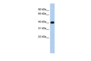 Anti-ERMN antibody, Internal used in Western Blot (WB). GTX45096