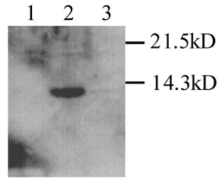 Anti-DAP12 antibody used in Western Blot (WB). GTX45098
