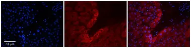 Anti-RPL18 antibody, N-term used in IHC (Paraffin sections) (IHC-P). GTX45108