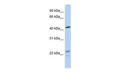 Anti-BCKDHA antibody, N-term used in Western Blot (WB). GTX45109