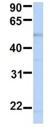 Anti-BCKDHA antibody, N-term used in Western Blot (WB). GTX45109