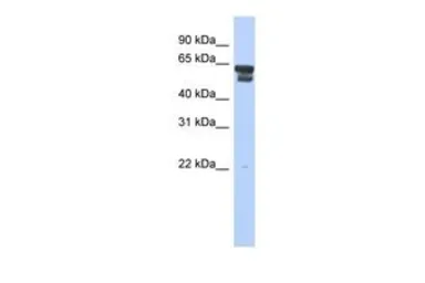 Anti-BLMH antibody, Internal used in Western Blot (WB). GTX45110