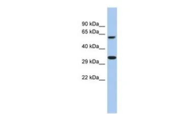 Anti-FAM26A antibody, C-term used in Western Blot (WB). GTX45114