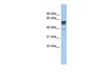 Anti-SPNS2 antibody, N-term used in Western Blot (WB). GTX45115