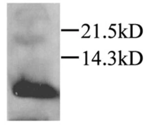 Anti-MIP3 alpha antibody used in Western Blot (WB). GTX45123