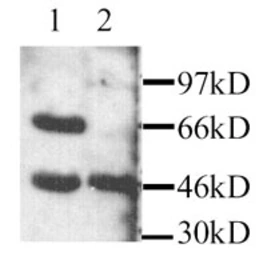 Anti-MEK1 antibody used in Western Blot (WB). GTX45127