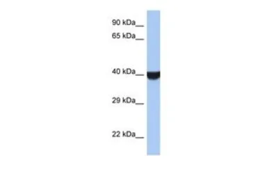 Anti-TMED8 antibody, Internal used in Western Blot (WB). GTX45130