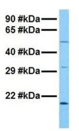 Anti-HERV-FRD antibody, N-term used in Western Blot (WB). GTX45132