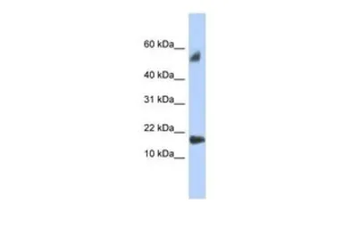 Anti-FLJ35767 antibody, Internal used in Western Blot (WB). GTX45134