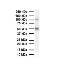 Anti-PRAME antibody, N-term used in Western Blot (WB). GTX45142