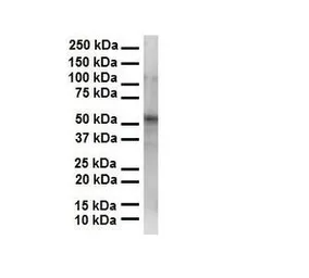 Anti-PRAME antibody, N-term used in Western Blot (WB). GTX45142
