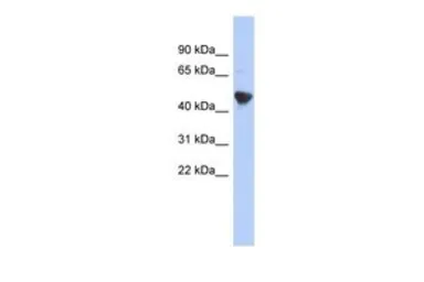 Anti-IER5L antibody, Internal used in Western Blot (WB). GTX45144