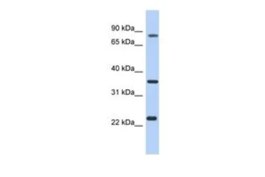 Anti-C17ORF82 antibody, N-term used in Western Blot (WB). GTX45145