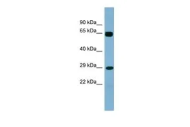 Anti-LRRN4CL antibody, Internal used in Western Blot (WB). GTX45147