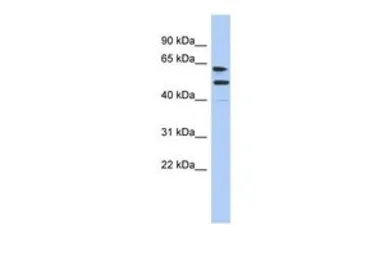 Anti-CXorf67 antibody, Internal used in Western Blot (WB). GTX45148