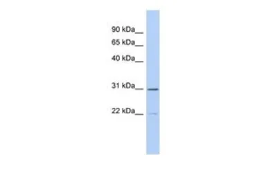 Anti-ZCCHC13 antibody, Internal used in Western Blot (WB). GTX45151