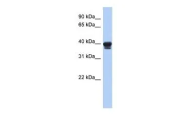 Anti-NAPE-PLD antibody, N-term used in Western Blot (WB). GTX45154
