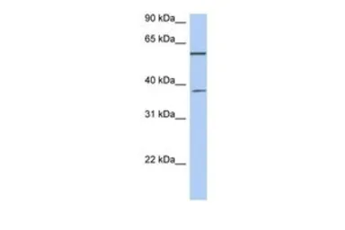 Anti-NUP43 antibody, Internal used in Western Blot (WB). GTX45155