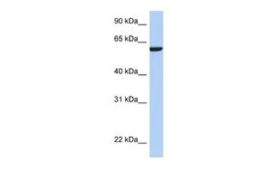 Anti-AMIGO3 antibody, N-term used in Western Blot (WB). GTX45156