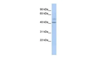 Anti-SPATC1 antibody, Internal used in Western Blot (WB). GTX45157