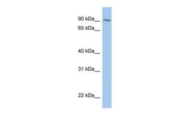 Anti-LRRC33 antibody, N-term used in Western Blot (WB). GTX45159