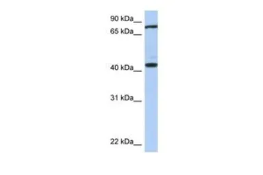 Anti-TEX9 antibody, Internal used in Western Blot (WB). GTX45163