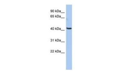 Anti-OLFML1 antibody, Internal used in Western Blot (WB). GTX45172