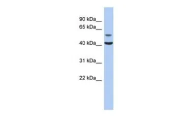 Anti-OLFML1 antibody, N-term used in Western Blot (WB). GTX45173