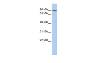 Anti-ANKRD47 antibody, N-term used in Western Blot (WB). GTX45175