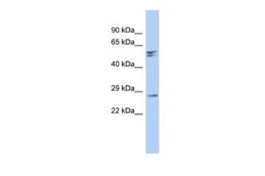 Anti-RD3 antibody, N-term used in Western Blot (WB). GTX45177