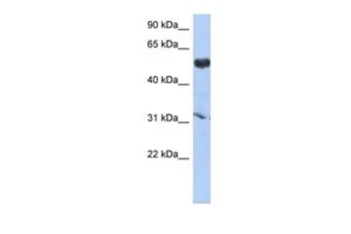 Anti-CYP4X1 antibody, Internal used in Western Blot (WB). GTX45204