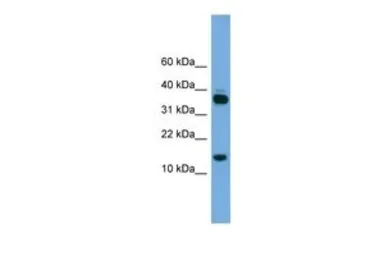 Anti-PRR15 antibody, Internal used in Western Blot (WB). GTX45209