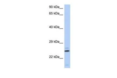 Anti-TTC9C antibody, N-term used in Western Blot (WB). GTX45218