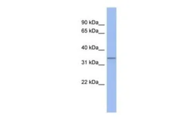Anti-C17ORF78 antibody, Internal used in Western Blot (WB). GTX45227