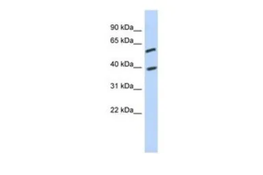 Anti-C6ORF146 antibody, Internal used in Western Blot (WB). GTX45235