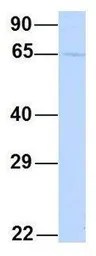 Anti-YTHDF3 antibody, N-term used in Western Blot (WB). GTX45260