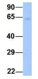 Anti-YTHDF3 antibody, N-term used in Western Blot (WB). GTX45261