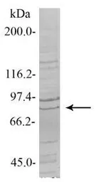Anti-SENP5 antibody, Internal used in Western Blot (WB). GTX45267