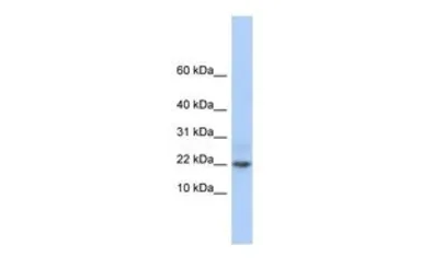 Anti-C9ORF25 antibody, Internal used in Western Blot (WB). GTX45271