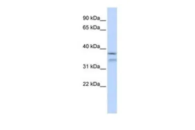 Anti-HYLS1 antibody, Internal used in Western Blot (WB). GTX45276
