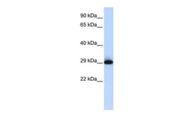Anti-SUSD3 antibody, N-term used in Western Blot (WB). GTX45277